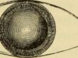 Cataract and Presbyopia in a single image